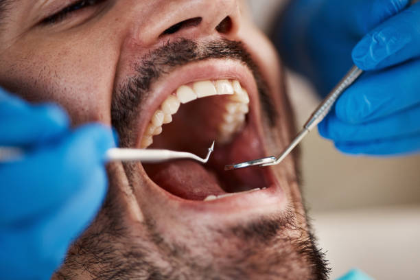 Best Broken Tooth Emergency  in St Joseph, MO