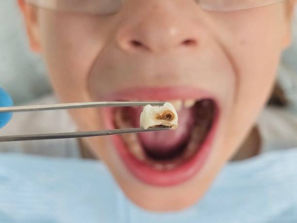 Best Broken Tooth Emergency  in St Joseph, MO
